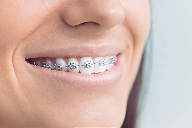 Trusted Fairmont, IL Dental Services Experts